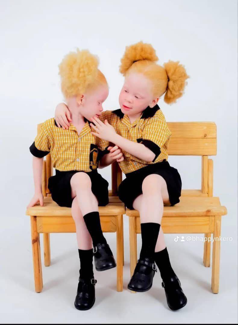 Two young learners with albinism sitting together on a bench in school uniform